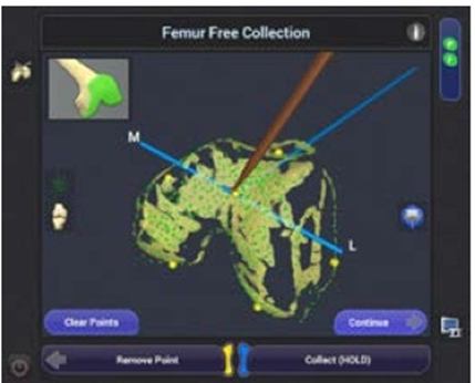 femur-free-collection