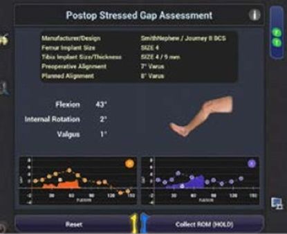 postop-stressed-gap-assesment